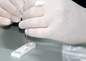 Testes rápidos para se detectar coronavírus são enviados a mais de 60 municípios baianos​