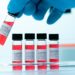 Japão começa a fornecer antiviral recém-aprovado para tratar covid-19