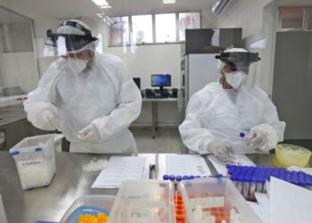 Lacen realiza mais de 20 mil testes para detecção de Covid-19 e valida laboratórios da rede privada 