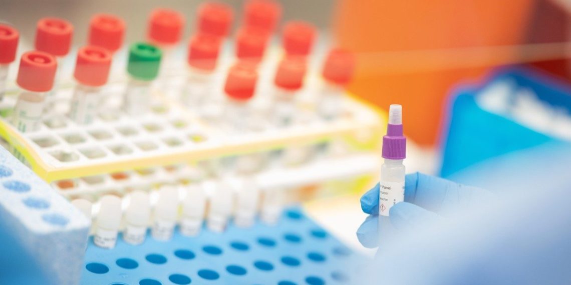 SESAB registra 32 novos óbitos pela Covid-19 e número de casos confirmados chega a 28.250