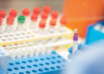 SESAB registra 32 novos óbitos pela Covid-19 e número de casos confirmados chega a 28.250