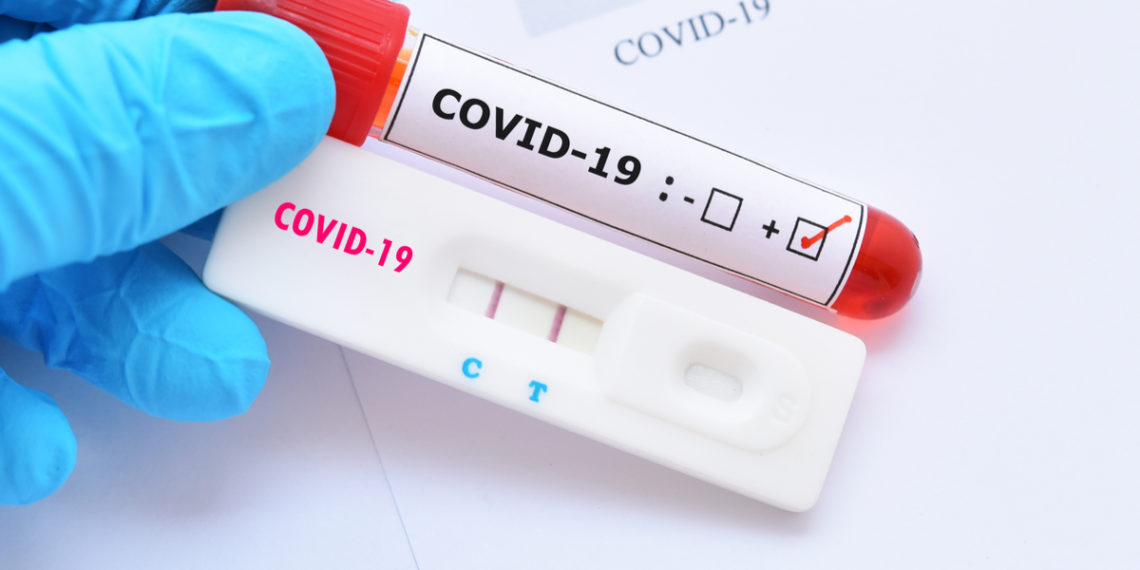 Covid-19: Coité confirma 12 novos casos e 21 recuperados; vírus ativos são 62