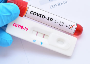 Covid-19: Coité confirma 12 novos casos e 21 recuperados; vírus ativos são 62