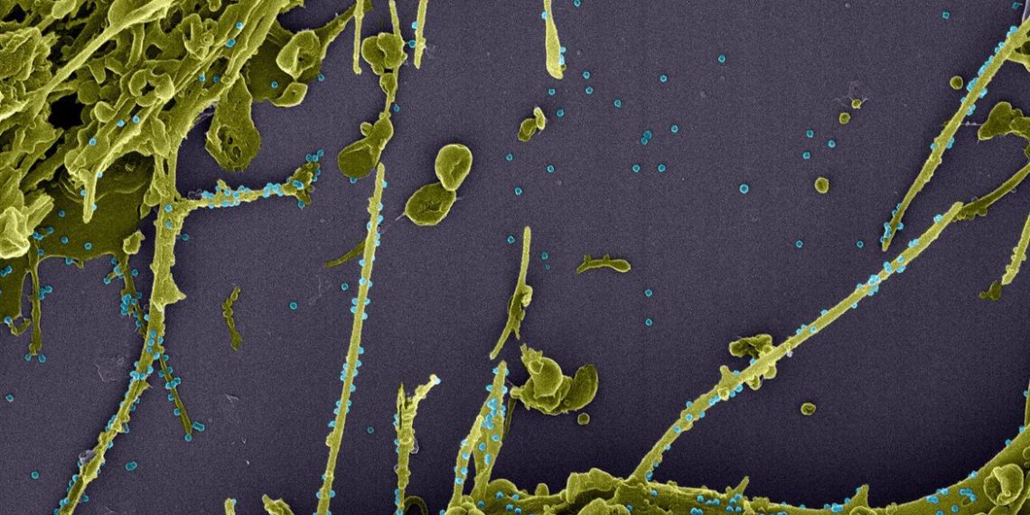 Anticorpos contra covid-19 duram pelo menos sete meses, mostra estudo