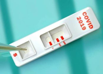 Covid-19: Coité confirma 81 novos casos e agora somam 2.815