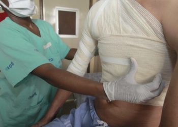 HGE terá a primeira residência médica em atendimento a queimados do Norte/Nordeste