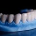 Sobreviventes da Covid-19 relatam perda de dentes depois da infecção