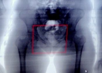 Cinco mulheres são flagradas quando tentavam entrar em presídio com drogas nas partes íntimas