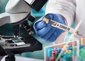 Exames para Covid-19: você sabe a diferença da sorologia para RT- PCR?