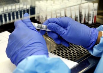 Estado confirma transmissão comunitária da variante da Covid-19 do Reino Unido