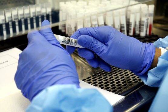 Estado confirma transmissão comunitária da variante da Covid-19 do Reino Unido