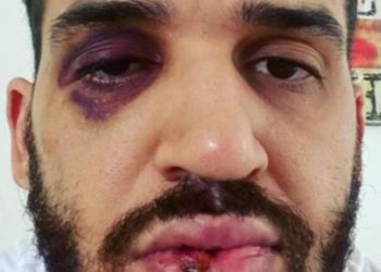 PR – Médico é agredido após alertar pessoas sobre riscos da Covid-19
