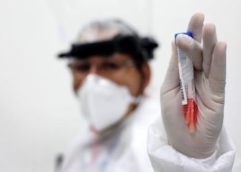 Lacen-BA ultrapassa marca de 1 milhão de testes de Covid-19 realizados