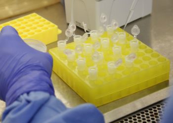 Testes para vacina contra HIV têm resultados promissores