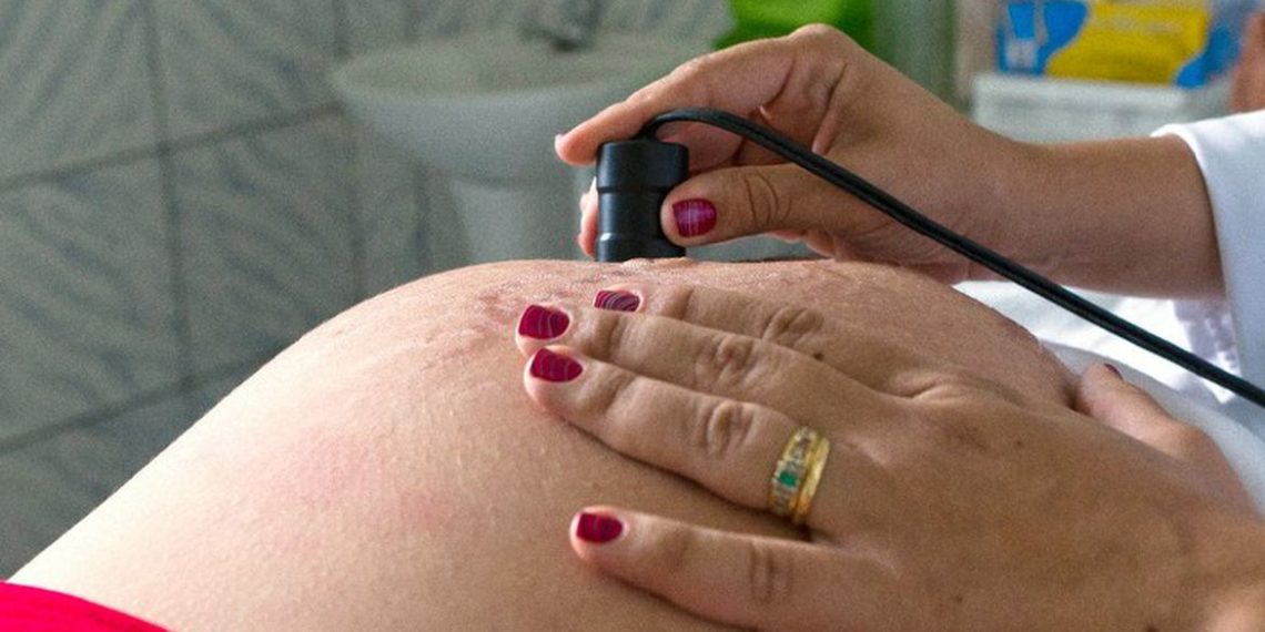 Número de óbitos de grávidas em 2021 já ultrapassa todo ano de 2020