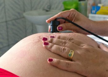 Número de óbitos de grávidas em 2021 já ultrapassa todo ano de 2020
