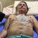 Flávio Bolsonaro: se presidente continuar disposto, não precisará de cirurgia