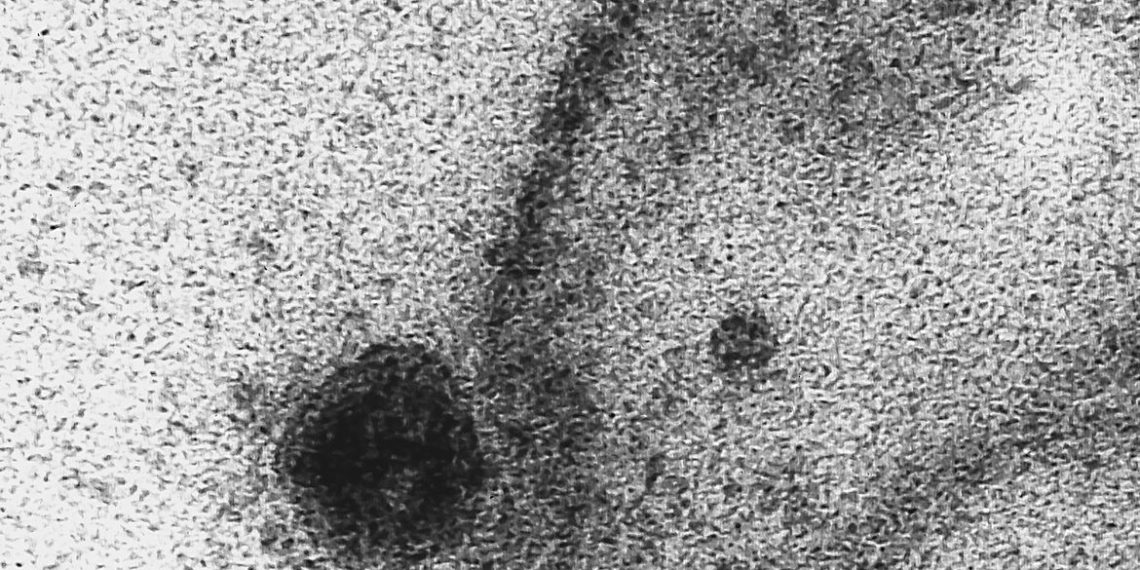 Aplicativo alimentado por tosses pode ajudar na detecção da covid-19