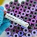 Estudo identifica pela 1ª vez infecção pulmonar causada pelo coronavírus em feto