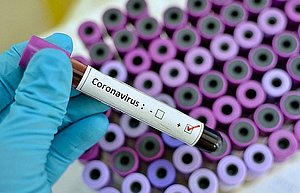 Estudo identifica pela 1ª vez infecção pulmonar causada pelo coronavírus em feto