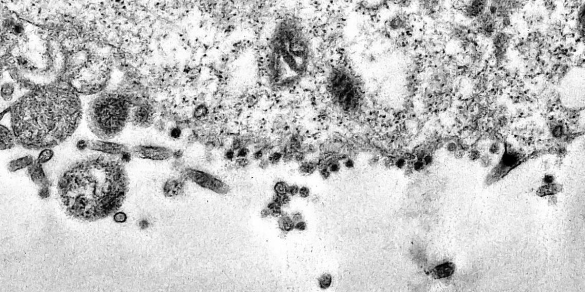 África do Sul detecta nova variante do coronavírus e estuda mutações