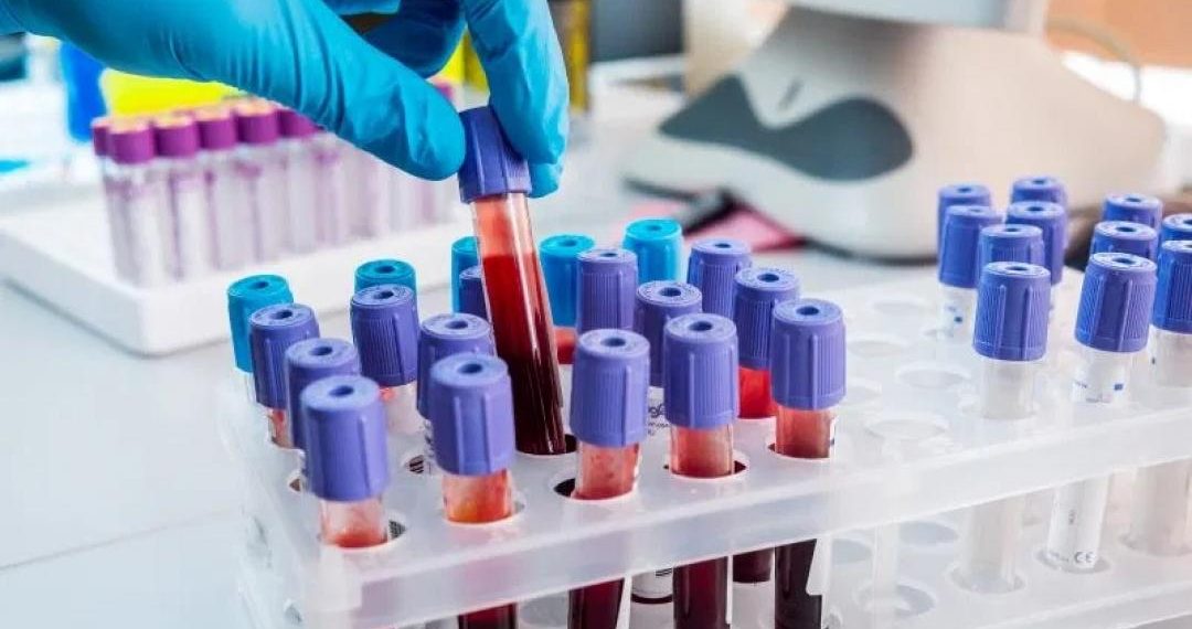 Cai para 5 o número de casos ativos da covid-19 em Coité