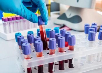 Cai para 5 o número de casos ativos da covid-19 em Coité