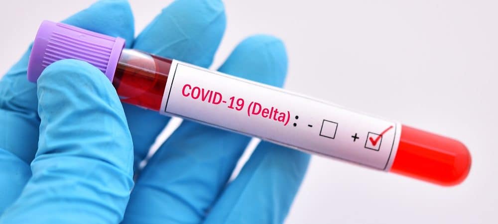 Bacia do Jacuípe – Nova Fátima confirma quatro casos da variante Delta da Covid-19