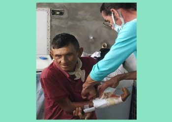 Coité – Idoso atacado por pit bull recebe alta, mas teve o dedo polegar amputado