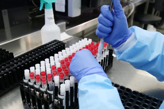 Variante Ômicron representa mais de 71% dos casos de coronavírus na Bahia