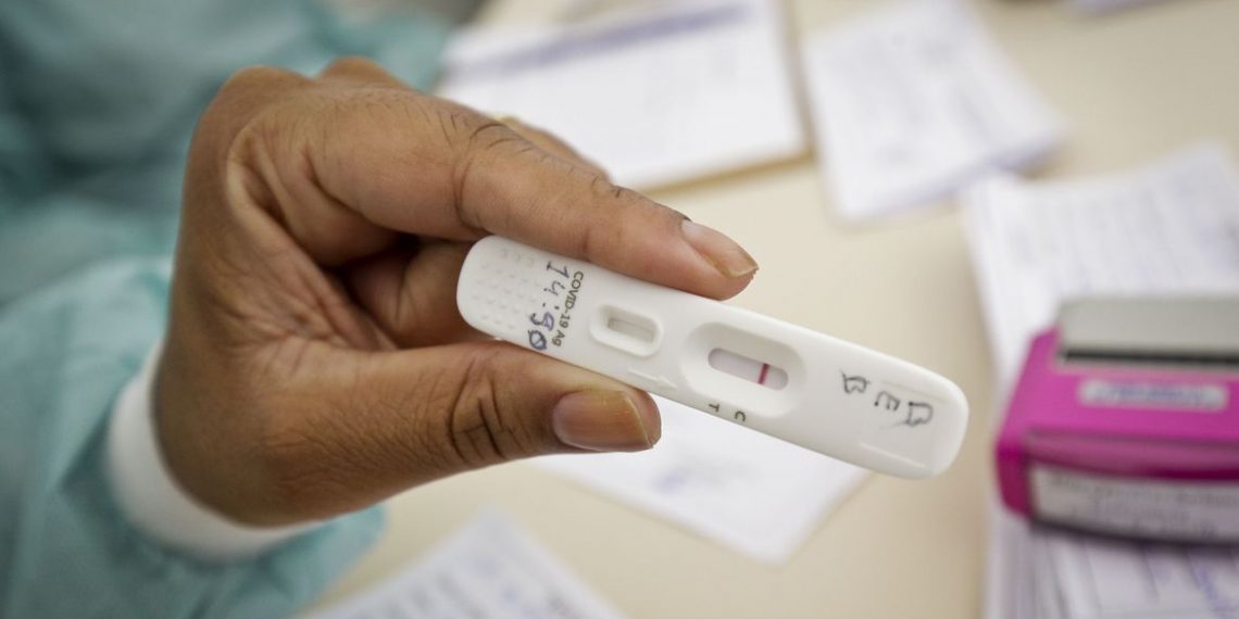 Anvisa aprova uso e comercialização de autoteste para covid-19