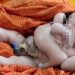 Índia – Bebê nascido com quatro braços e quatro pernas é tratado como divindade