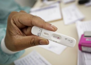 Anvisa aprova primeira marca de autoteste do Brasil