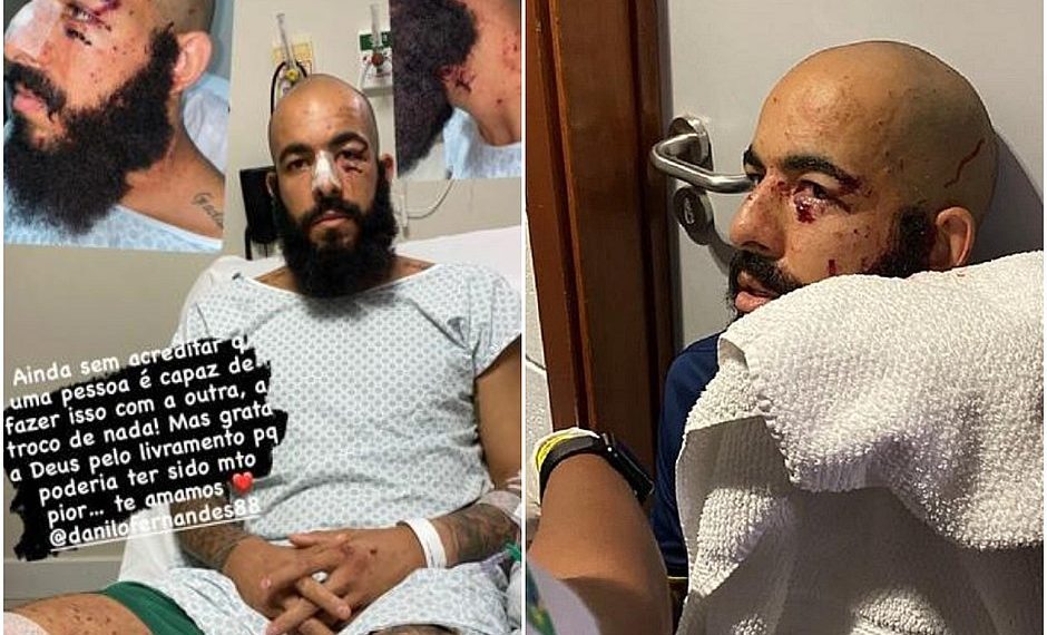 Danilo Fernandes goleiro do Bahia mostra ferimentos: ‘É preciso que todos vejam o que aconteceu’