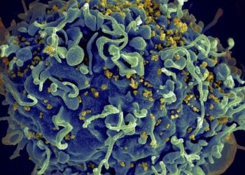 Primeira mulher declarada curada do HIV após transplante de células-tronco