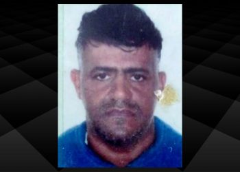 Feira: homem dá entrada no HGCA e morre após passar mal em clínica de implante capilar