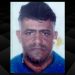 Feira: homem dá entrada no HGCA e morre após passar mal em clínica de implante capilar