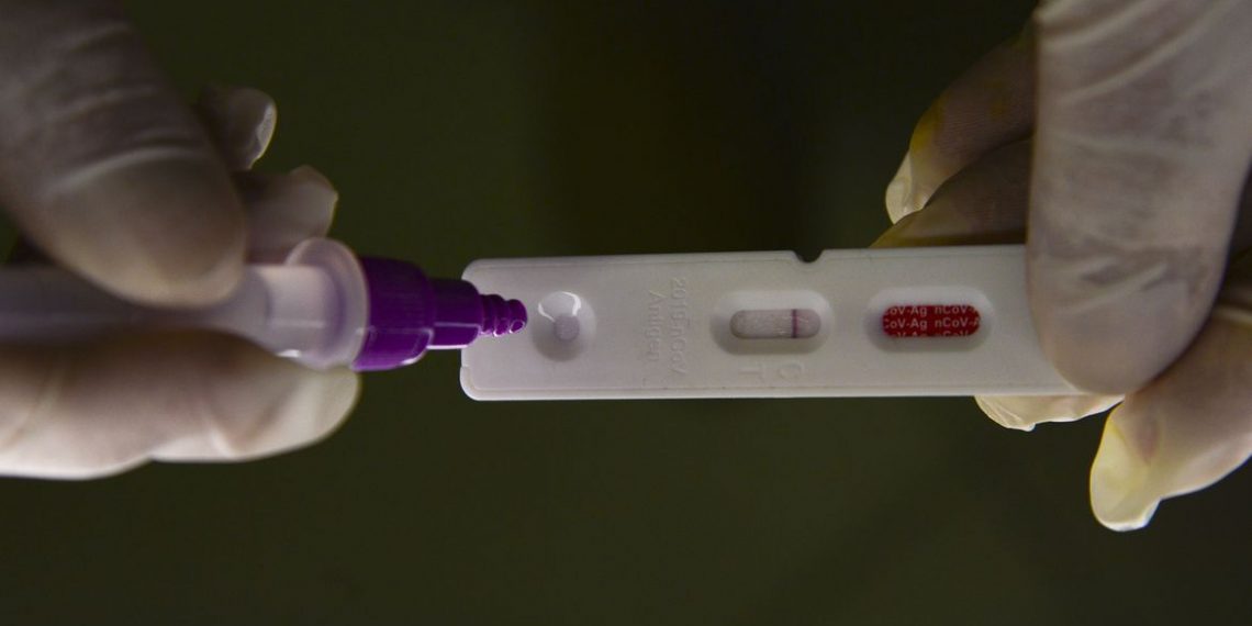 Pesquisadores identificam método capaz de prever gravidade da covid-19