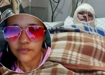 MS – Mulher acorda de coma, acusa marido de atear fogo nela e morre 2 dias depois