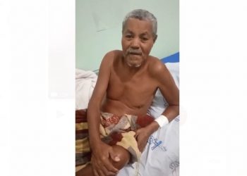 Coité – Depois de ‘força tarefa’ idoso com perna necrosada é transferido