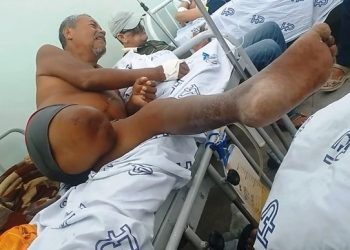 Coité – Idoso de 64 anos com perna necrosada aguarda transferência do HP há 10 dias