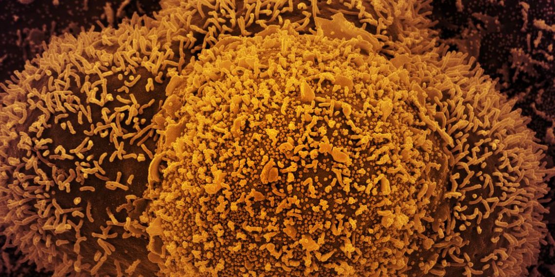 Fiocruz alerta para alta de casos de covid-19 em quatro estados