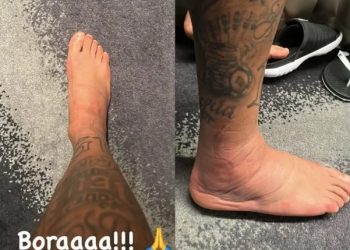 Neymar posta foto de tornozelo inchado durante tratamento na Seleção: “Bora”