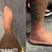 Neymar posta foto de tornozelo inchado durante tratamento na Seleção: “Bora”