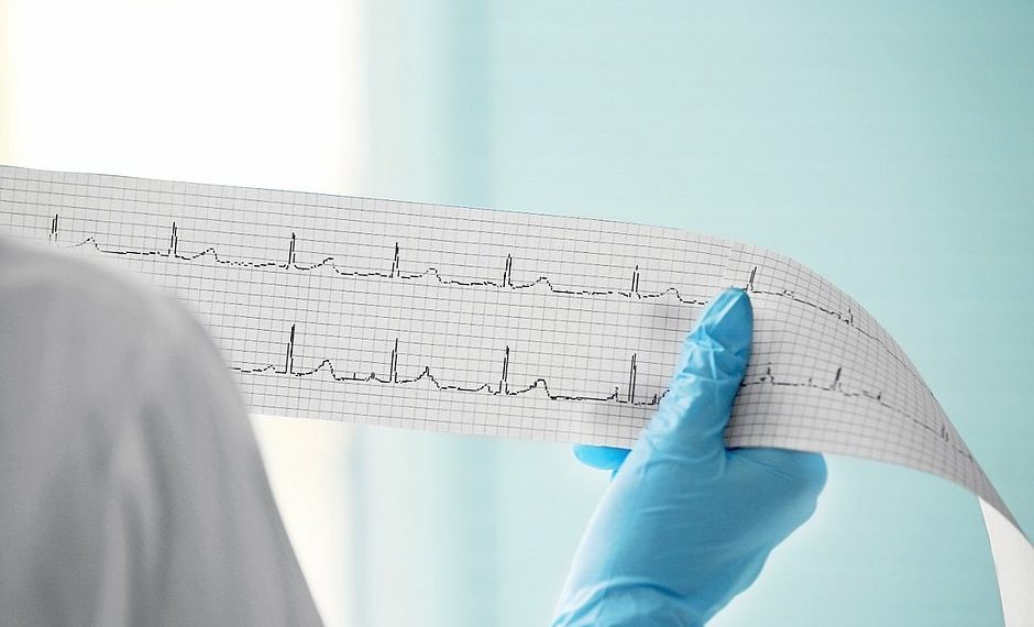 Estudos indicam complicações cardiovasculares em quem teve covid-19