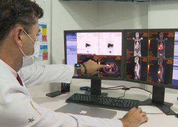 Inca prevê 44 mil casos novos de câncer colorretal no Brasil por ano