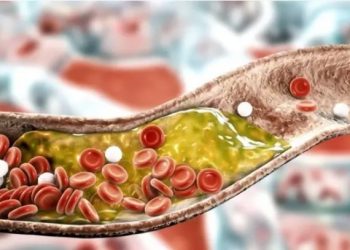 Anvisa aprova remédio para colesterol injetado apenas 2 vezes por ano