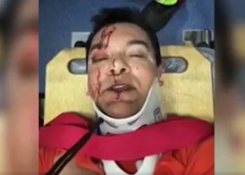 GO – Cantor gospel Regis Danese sofre acidente e grava vídeo sangrando: ‘Orem por mim’