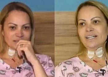 Solange Almeida revela dificuldade para respirar após lesões por uso de cigarro eletrônico