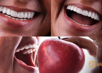 Coité – Instituto Ortocentro realiza a 5ª Maratona de Implantes nos próximos dias 04, 05 e 06/12